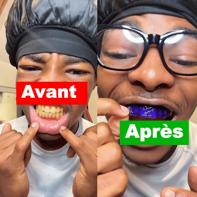 Bandes dentaires 🦷 Ultra-violet 🟣 (V34)