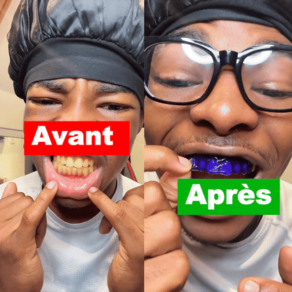 Bandes dentaires 🦷 Ultra-violet 🟣 (V34)